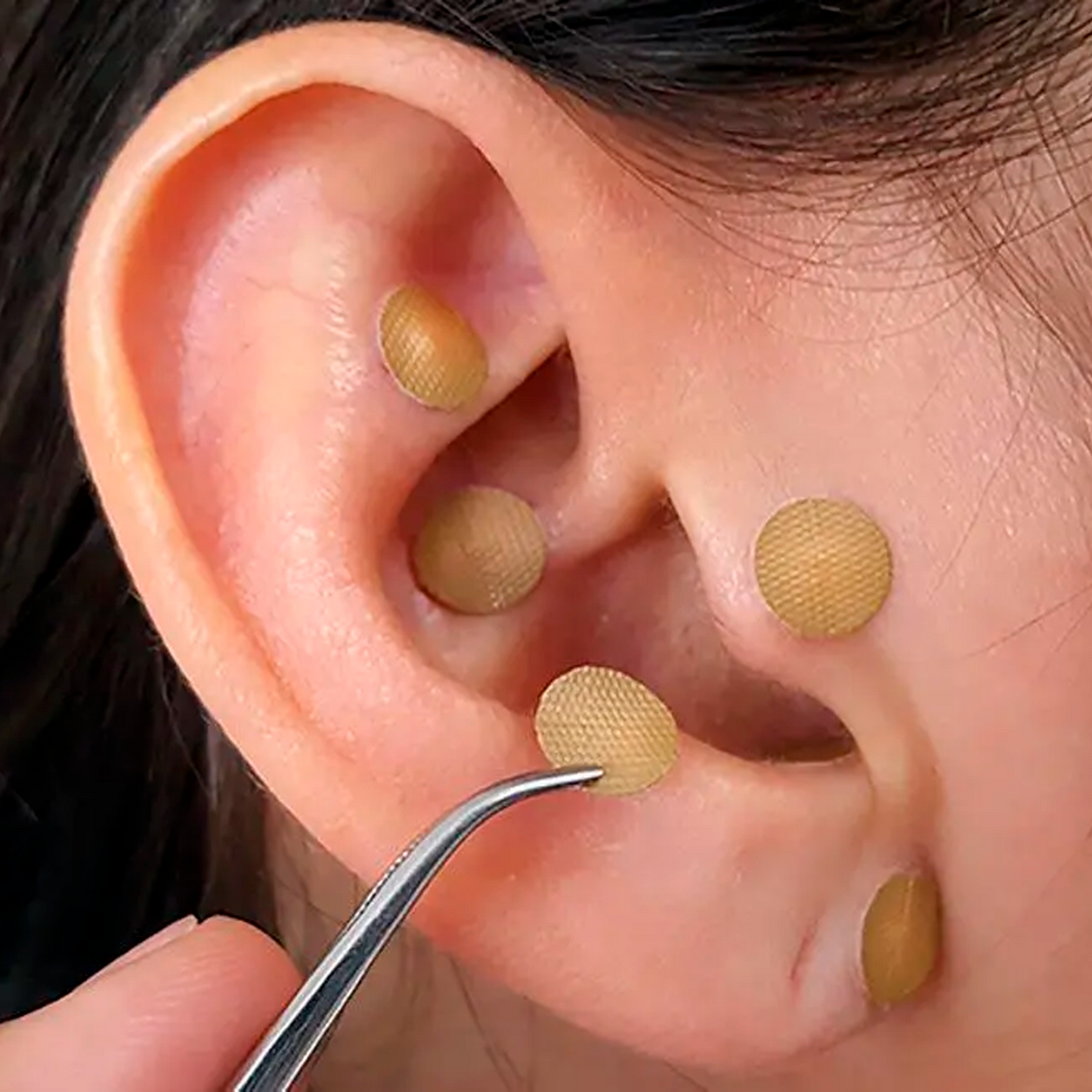 Consulta de Auriculoterapia